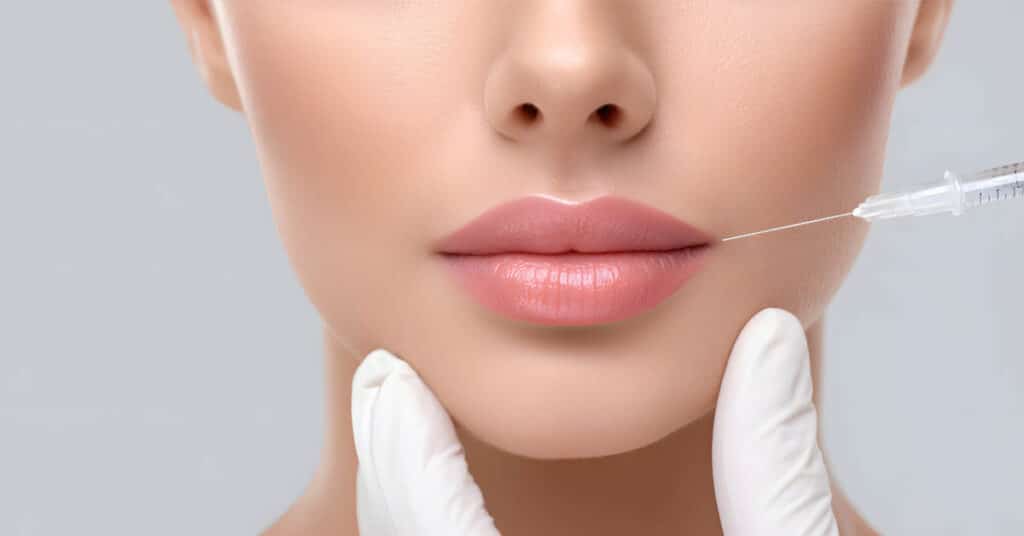 Preenchimento Facial: como funciona, benefícios e resultados Naturais
