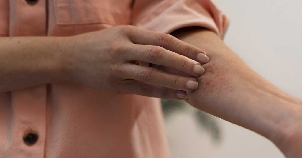 Doenças tratadas pela dermatologia clínica: guia completo 2026