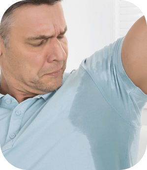 Hidradenite supurativa