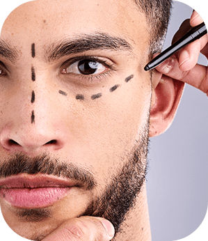 Toxina Botulínica em Moema